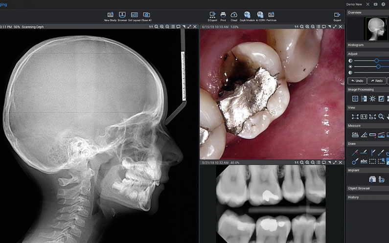Conoce los diferentes tipos de radiografía dental y su importancia en la salud oral