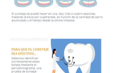 Todo lo que debes saber sobre el curetaje dental: procedimiento, beneficios y cuidados posteriores.